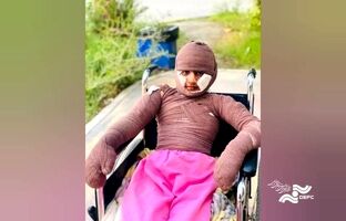 «هدا»، دختری از میناب/ مستندی درباره یکی از بازماندگان جنگ رمضان