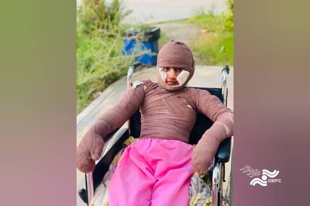 «هدا»، دختری از میناب/ مستندی درباره یکی از بازماندگان جنگ رمضان
