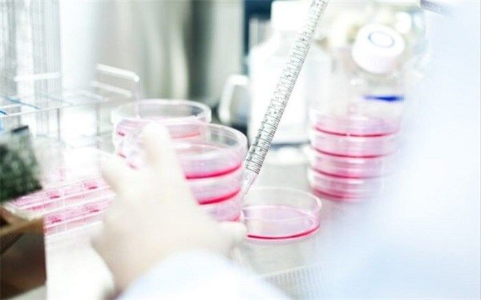 سلول درمانی جایگزین پیوند کلیه می شود