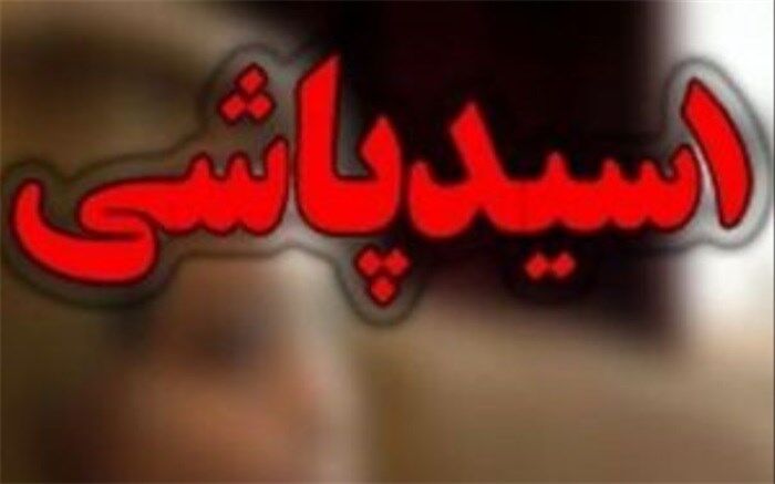 زوج جوان قربانی اسیدپاشی پدر