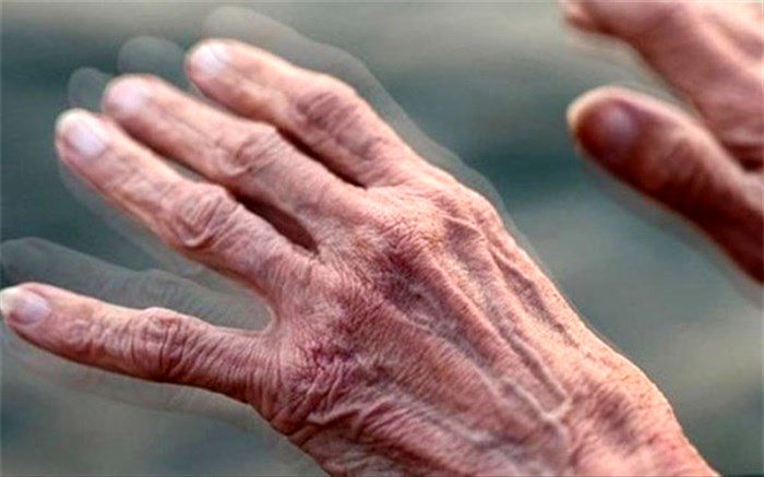 «پارکینسون» چه اختلالاتی در بدن ایجاد می کند؟