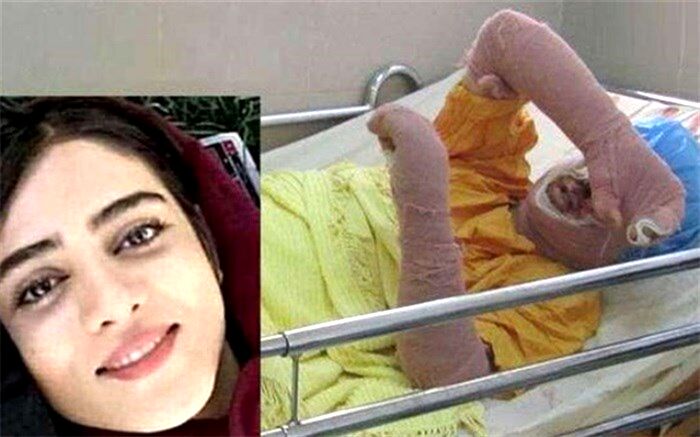 آسیب‌‌شناسی حقوقی‌ و اجتماعی یک خودسوزی