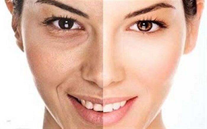 5 روش طبیعی برای کاهش چین و چروک پوست