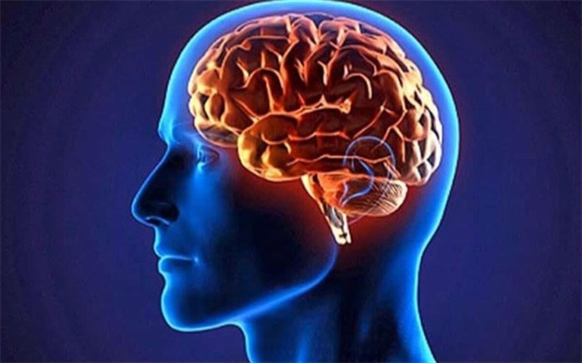 تشخیص افسردگی و اختلالات خواب با استفاده از نقشه‌برداری مغز