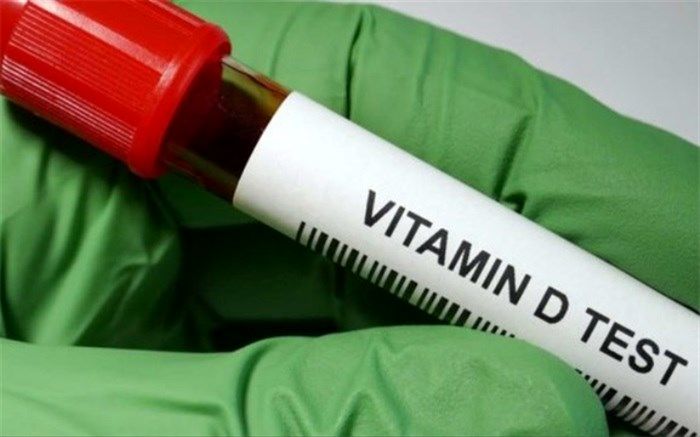 تاثیر کمبود ویتامین D بر التهاب مفصلیِ شایع در کودکان