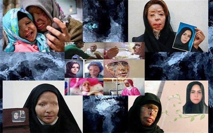 طرح تشدید مجازات اسیدپاشی  در آستانه تبدیل به قانون