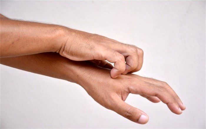 10 دلیل خارش شدید پوست