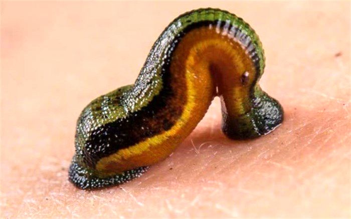 همه چیز درباره زالو درمانی