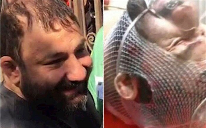 «شرور معروف» زنده است؛ آبمیوه‌ای که زهر شد + تصویر