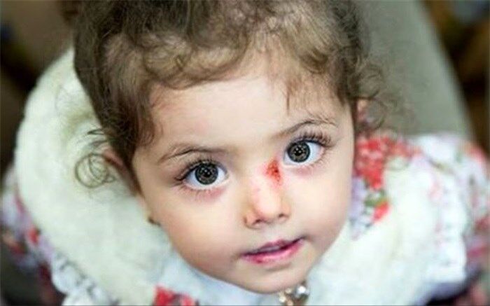تحریم، <آواها> را پرپر می کند