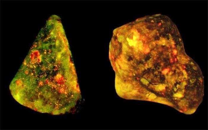 فاکتورهای خطرزا در بروز سنگ کیسه صفرا