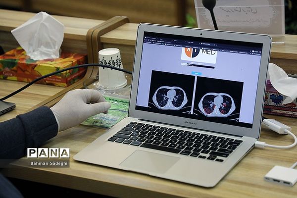 رونمایی از سامانه تشخیص پونومی  کویید ۱۹
