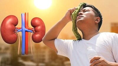 چگونه در روزهای گرم از کلیه‌های خود محافظت کنیم؟