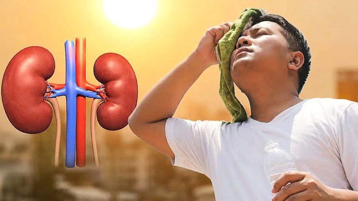 چگونه در روزهای گرم از کلیه‌های خود محافظت کنیم؟