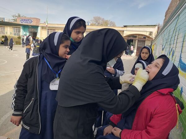 وارنیش فلوراید برای دانش آموزان دبستان ناهید نخودی 