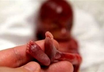 حدود ۳۰ درصد بارداری‌ها خودبه‌خود پایان می‌یابد