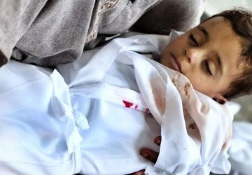 مرگ کودکان غزه در سکوت مجامع جهانی